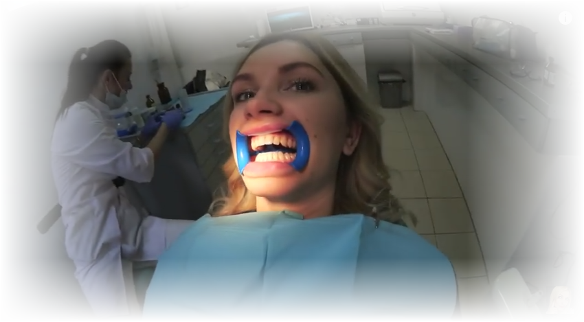Лучшее отбеливание зубов в домашних условиях